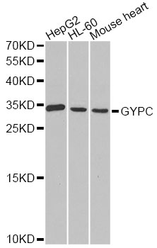 GYPC / Glycophorin C Antibody - Western blot analysis of extracts of various cell lines, using GYPC antibody at 1:1000 dilution. The secondary antibody used was an HRP Goat Anti-Rabbit IgG (H+L) at 1:10000 dilution. Lysates were loaded 25ug per lane and 3% nonfat dry milk in TBST was used for blocking. An ECL Kit was used for detection and the exposure time was 90s.