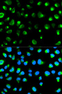 GYPC / Glycophorin C Antibody - Immunofluorescence analysis of MCF-7 cells using GYPC antibody. Blue: DAPI for nuclear staining.