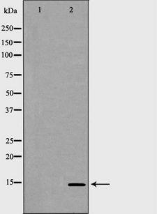 GYPC / Glycophorin C Antibody - Western blot analysis of K562 whole cells lysates using GYPC antibody. The lane on the left is treated with the antigen-specific peptide.