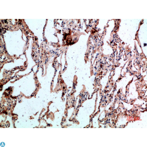 GYPC / Glycophorin C Antibody - Immunohistochemical analysis of paraffin-embedded human-lung, antibody was diluted at 1:200.