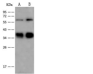 GYPC / Glycophorin C Antibody - Anti-GYPC rabbit polyclonal antibody at 1:500 dilution. Lane A: TF-1 Whole Cell Lysate. Lane B: K562 Whole Cell Lysate. Lysates/proteins at 30 ug per lane. Secondary: Goat Anti-Rabbit IgG (H+L)/HRP at 1/10000 dilution. Developed using the ECL technique. Performed under reducing conditions. Predicted band size: 14 kDa.