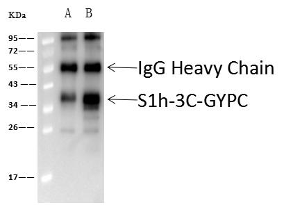 GYPC / Glycophorin C Antibody - S1h-3C-GYPC was immunoprecipitated using: Lane A: 0.5 mg TF-1 Whole Cell Lysate. Lane B: 0.5 mg K562 Whole Cell Lysate. 2 uL anti-S1h-3C-GYPC rabbit polyclonal antibody and 60 ug of Immunomagnetic beads Protein A/G. Primary antibody: Anti-S1h-3C-GYPC rabbit polyclonal antibody, at 1:100 dilution. Secondary antibody: Goat Anti-Rabbit IgG (H+L)/HRP at 1/10000 dilution. Developed using the ECL technique. Performed under reducing conditions. Predicted band size: 14 kDa. Observed band size: 37 kDa.