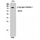 GYS1 / Glycogen Synthase Antibody - Western blot of Phospho-Glycogen Synthase 1 (S645) antibody