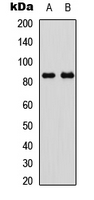 GYS1 / Glycogen Synthase Antibody - Western blot analysis of GYS1 (pS645) expression in HeLa insulin-treated (A); NIH3T3 insulin-treated (B) whole cell lysates.