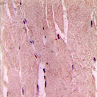 GYS1 / Glycogen Synthase Antibody - Immunohistochemical analysis of GYS1 (pS645) staining in human skeletal muscle formalin fixed paraffin embedded tissue section. The section was pre-treated using heat mediated antigen retrieval with sodium citrate buffer (pH 6.0). The section was then incubated with the antibody at room temperature and detected using an HRP conjugated compact polymer system. DAB was used as the chromogen. The section was then counterstained with hematoxylin and mounted with DPX.