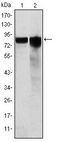 GYS1 / Glycogen Synthase Antibody - GYS1 Antibody in Western Blot (WB)
