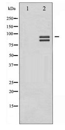 GYS1 / Glycogen Synthase Antibody - Western blot of Glycogen Synthase expression in Serum treated HeLa whole cell lysates,The lane on the left is treated with the antigen-specific peptide.
