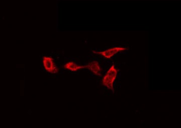 GYS1 / Glycogen Synthase Antibody - Staining NIH-3T3 cells by IF/ICC. The samples were fixed with PFA and permeabilized in 0.1% Triton X-100, then blocked in 10% serum for 45 min at 25°C. The primary antibody was diluted at 1:200 and incubated with the sample for 1 hour at 37°C. An Alexa Fluor 594 conjugated goat anti-rabbit IgG (H+L) Ab, diluted at 1/600, was used as the secondary antibody.