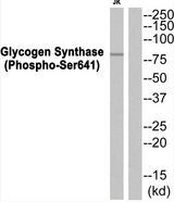 GYS1 / Glycogen Synthase Antibody - Western blot of extracts from HeLa cells, using Glycogen Synthase (Phospho-Ser641) Antibody .