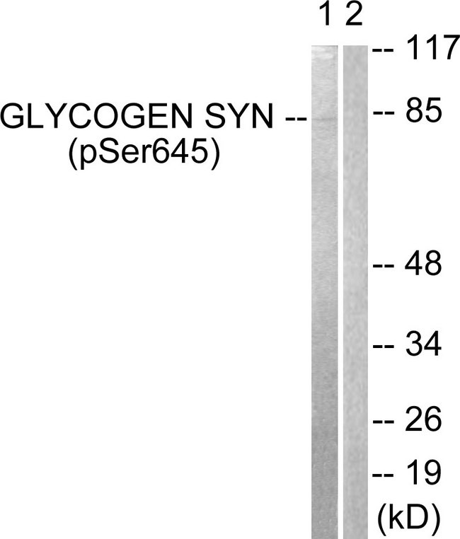 GYS1 / Glycogen Synthase Antibody - Western blot analysis of lysates from NIH/3T3 cells treated with PMA 125ng/ml 30', using Glycogen Synthase (Phospho-Ser645) Antibody. The lane on the right is blocked with the phospho peptide.
