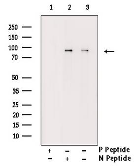 GYS1 / Glycogen Synthase Antibody - Western blot analysis of Phospho-Glycogen Synthase (Ser645) antibody expression in PMA treated NIH-3T3 cells lysates. The lane on the right is treated with the antigen-specific peptide.