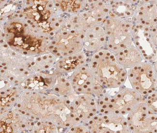 GYS1 / Glycogen Synthase Antibody - 1:200 staining human kidney tissue by IHC-P. The tissue was formaldehyde fixed and a heat mediated antigen retrieval step in citrate buffer was performed. The tissue was then blocked and incubated with the antibody for 1.5 hours at 22°C. An HRP conjugated goat anti-rabbit antibody was used as the secondary.