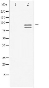 GYS1 / Glycogen Synthase Antibody - Western blot analysis of Glycogen Synthase phosphorylation expression in PMA treated NIH-3T3 whole cells lysates. The lane on the left is treated with the antigen-specific peptide.
