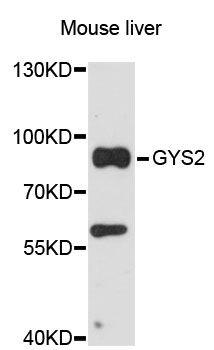 GYS2 Antibody - Western blot analysis of extracts of mouse liver, using GYS2 antibody at 1:3000 dilution. The secondary antibody used was an HRP Goat Anti-Rabbit IgG (H+L) at 1:10000 dilution. Lysates were loaded 25ug per lane and 3% nonfat dry milk in TBST was used for blocking. An ECL Kit was used for detection and the exposure time was 30s.