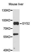 GYS2 Antibody - Western blot analysis of extracts of mouse liver, using GYS2 antibody at 1:3000 dilution. The secondary antibody used was an HRP Goat Anti-Rabbit IgG (H+L) at 1:10000 dilution. Lysates were loaded 25ug per lane and 3% nonfat dry milk in TBST was used for blocking. An ECL Kit was used for detection and the exposure time was 30s.