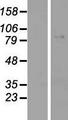 GYS2 Protein - Western validation with an anti-DDK antibody * L: Control HEK293 lysate R: Over-expression lysate