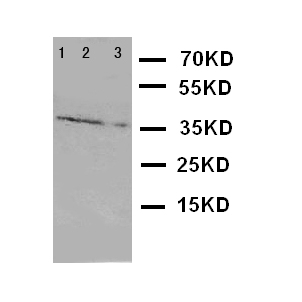 GZMA / Granzyme A Antibody - WB of GZMA / Granzyme A antibody. Lane 1: JURKAT Cell Lysate. Lane 2: CEM Cell Lysate. Lane 3: RAJI Cell Lysate.