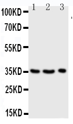 GZMA / Granzyme A Antibody - Anti-Granzyme A antibody, Western blotting Lane 1: JURKAT Cell LysateLane 2: CEM Cell LysateLane 3: RAJI Cell Lysate