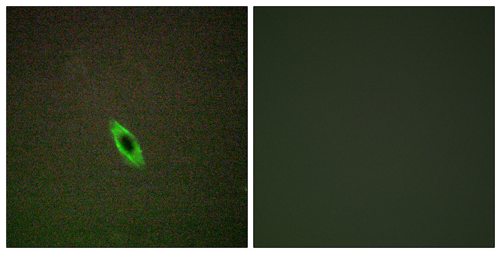 GZMA / Granzyme A Antibody - Immunofluorescence analysis of HepG2 cells, using GRAA Antibody. The picture on the right is blocked with the synthesized peptide.