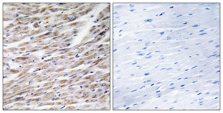 GZMA / Granzyme A Antibody - Immunohistochemistry analysis of paraffin-embedded human heart tissue, using GRAA Antibody. The picture on the right is blocked with the synthesized peptide.