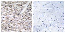 GZMA / Granzyme A Antibody - Immunohistochemistry analysis of paraffin-embedded human heart tissue, using GRAA Antibody. The picture on the right is blocked with the synthesized peptide.