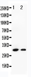 GZMB / Granzyme B Antibody - WB of GZMB / Granzyme B antibody. All lanes: Anti-GZMB at 0.5ug/ml. Lane 1: SMMC Whole Cell Lysate at 40ug. Lane 2: HEPA Whole Cell Lysate at 40ug. Predicted bind size: 28KD. Observed bind size: 28KD.