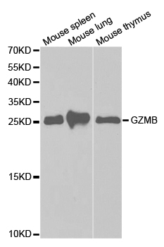 GZMB / Granzyme B Antibody - Western blot analysis of extracts of various cell lines.