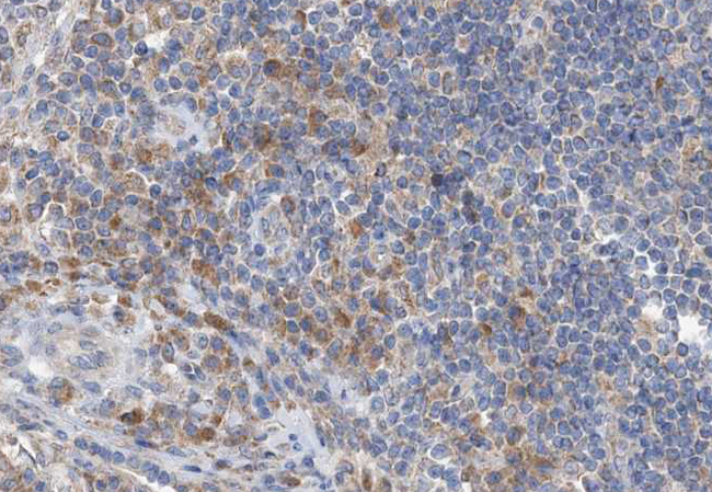 GZMB / Granzyme B Antibody - 1:100 staining human lymph node tissue by IHC-P. The tissue was formaldehyde fixed and a heat mediated antigen retrieval step in citrate buffer was performed. The tissue was then blocked and incubated with the antibody for 1.5 hours at 22°C. An HRP conjugated goat anti-rabbit antibody was used as the secondary.