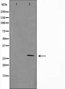 GZMB / Granzyme B Antibody - Western blot analysis on NIH-3T3 cell lysates using Granzyme B antibody. The lane on the left is treated with the antigen-specific peptide.