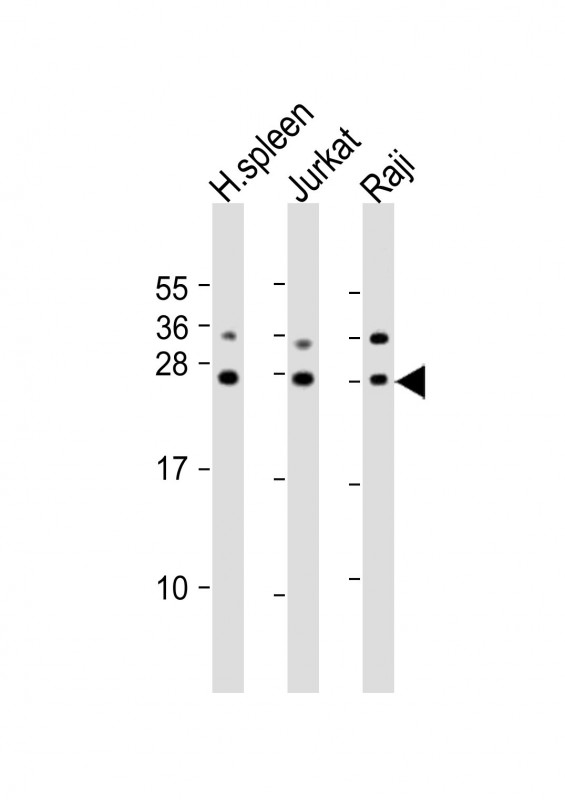 GZMH / Granzyme H Antibody - All lanes: Anti-GZMH Antibody (N-Term) at 1:2000 dilution. Lane 1: human spleen lysates. Lane 2: Jurkat whole cell lysates. Lane 3: Raji whole cell lysates Lysates/proteins at 20 ug per lane. Secondary Goat Anti-Rabbit IgG, (H+L), Peroxidase conjugated at 1:10000 dilution. Predicted band size: 27 kDa. Blocking/Dilution buffer: 5% NFDM/TBST.