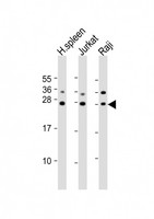 GZMH / Granzyme H Antibody - All lanes: Anti-GZMH Antibody (N-Term) at 1:2000 dilution. Lane 1: human spleen lysates. Lane 2: Jurkat whole cell lysates. Lane 3: Raji whole cell lysates Lysates/proteins at 20 ug per lane. Secondary Goat Anti-Rabbit IgG, (H+L), Peroxidase conjugated at 1:10000 dilution. Predicted band size: 27 kDa. Blocking/Dilution buffer: 5% NFDM/TBST.
