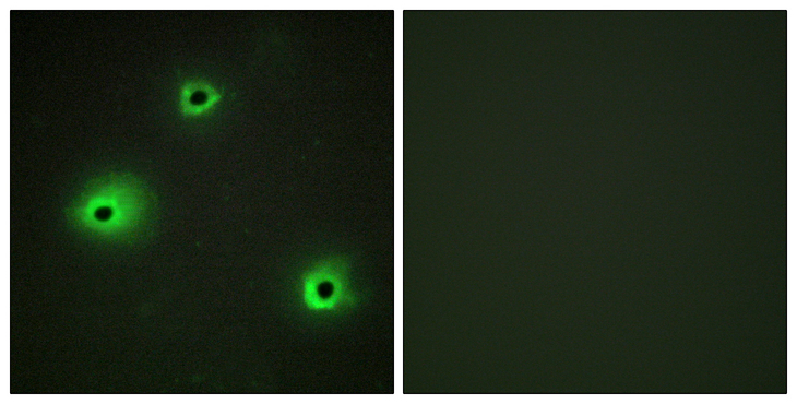GZMH / Granzyme H Antibody - Immunofluorescence analysis of A549 cells, using GRAH Antibody. The picture on the right is blocked with the synthesized peptide.