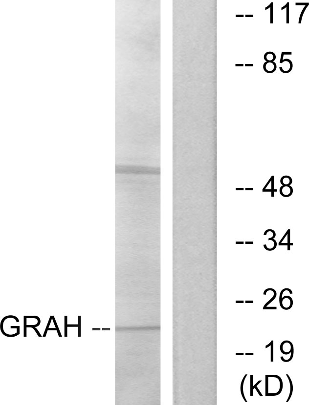 GZMH / Granzyme H Antibody - Western blot analysis of lysates from K562 cells, using GRAH Antibody. The lane on the right is blocked with the synthesized peptide.