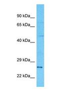 GZMH / Granzyme H Antibody - Western blot of GZMH Antibody with human 786-0 Whole Cell lysate.  This image was taken for the unconjugated form of this product. Other forms have not been tested.