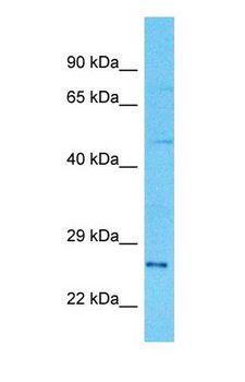 GZMH / Granzyme H Antibody - Western blot of GZMH Antibody with human 786-0 Whole Cell lysate.  This image was taken for the unconjugated form of this product. Other forms have not been tested.