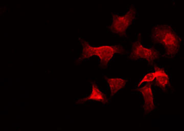 GZMH / Granzyme H Antibody - Staining HeLa cells by IF/ICC. The samples were fixed with PFA and permeabilized in 0.1% Triton X-100, then blocked in 10% serum for 45 min at 25°C. The primary antibody was diluted at 1:200 and incubated with the sample for 1 hour at 37°C. An Alexa Fluor 594 conjugated goat anti-rabbit IgG (H+L) Ab, diluted at 1/600, was used as the secondary antibody.