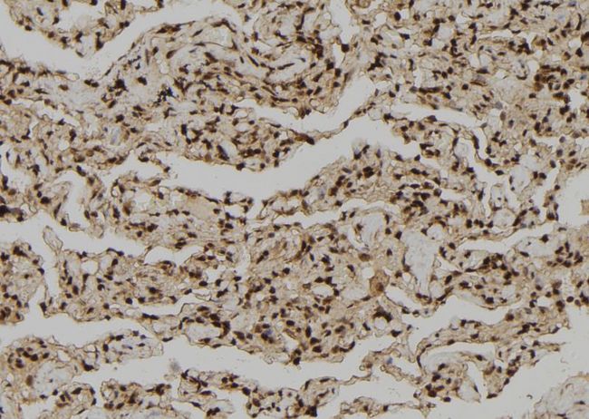 GZMH / Granzyme H Antibody - 1:100 staining human lung tissue by IHC-P. The sample was formaldehyde fixed and a heat mediated antigen retrieval step in citrate buffer was performed. The sample was then blocked and incubated with the antibody for 1.5 hours at 22°C. An HRP conjugated goat anti-rabbit antibody was used as the secondary.