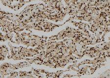 GZMH / Granzyme H Antibody - 1:100 staining human lung tissue by IHC-P. The sample was formaldehyde fixed and a heat mediated antigen retrieval step in citrate buffer was performed. The sample was then blocked and incubated with the antibody for 1.5 hours at 22°C. An HRP conjugated goat anti-rabbit antibody was used as the secondary.