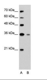 GZMH / Granzyme H Antibody - A: Marker, B: Jurkat Cell Lysate.  This image was taken for the unconjugated form of this product. Other forms have not been tested.