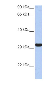 GZMK / Granzyme K Antibody - GZMK / Granzyme K antibody Western blot of Fetal Spleen lysate. This image was taken for the unconjugated form of this product. Other forms have not been tested.
