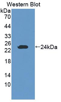 GZMK / Granzyme K Antibody - Western blot of GZMK / Granzyme K antibody.