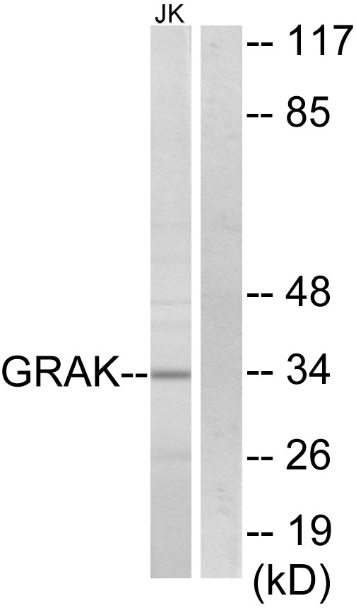 GZMK / Granzyme K Antibody - Western blot analysis of lysates from Jurkat cells, using GRAK Antibody. The lane on the right is blocked with the synthesized peptide.