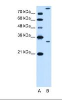 GZMK / Granzyme K Antibody - Lane A: Marker. Lane B: HepG2 cell lysate. Antibody concentration: 0.5 ug/ml. Gel concentration: 12%.  This image was taken for the unconjugated form of this product. Other forms have not been tested.