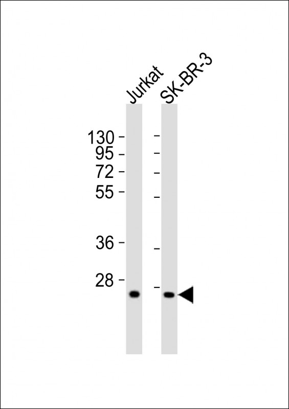 GZMK / Granzyme K Antibody - All lanes : Anti-GZMK Antibody at 1:2000 dilution Lane 1: Jurkat whole cell lysates Lane 2: SK-BR-3 whole cell lysates Lysates/proteins at 20 ug per lane. Secondary Goat Anti-Rabbit IgG, (H+L), Peroxidase conjugated at 1/10000 dilution Predicted band size : 29 kDa Blocking/Dilution buffer: 5% NFDM/TBST.
