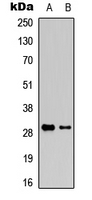 GZMK / Granzyme K Antibody - Western blot analysis of Granzyme K expression in Jurkat (A); mouse liver (B) whole cell lysates.