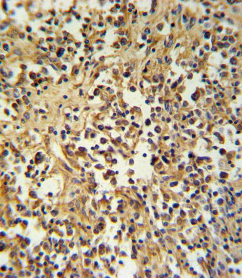 GZMM / Granzyme M Antibody - GZMM Antibody IHC of formalin-fixed and paraffin-embedded human lymph tissue followed by peroxidase-conjugated secondary antibody and DAB staining.