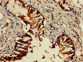GZMM / Granzyme M Antibody - Immunohistochemistry of paraffin-embedded human lung tissue at dilution of 1:100