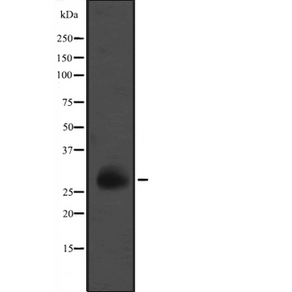 GZMM / Granzyme M Antibody - Western blot analysis of GZMM expression in K562 cells line lysates. The lane on the left is treated with the antigen-specific peptide.