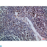GZMM / Granzyme M Antibody - Immunohistochemical analysis of paraffin-embedded Human-tonsil, antibody was diluted at 1:100.