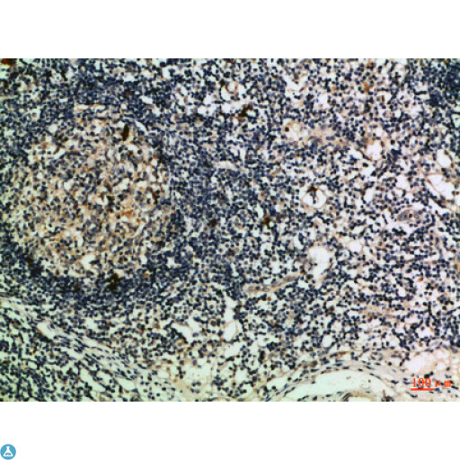 GZMM / Granzyme M Antibody - Immunohistochemical analysis of paraffin-embedded human-lymph, antibody was diluted at 1:100.